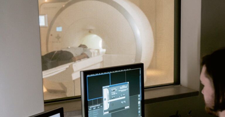 Alzheimerin tauti - Läpimurto Alzheimerin taudin tutkimuksessa: SORLA-proteiinin vaikutus aivosolujen viestintään