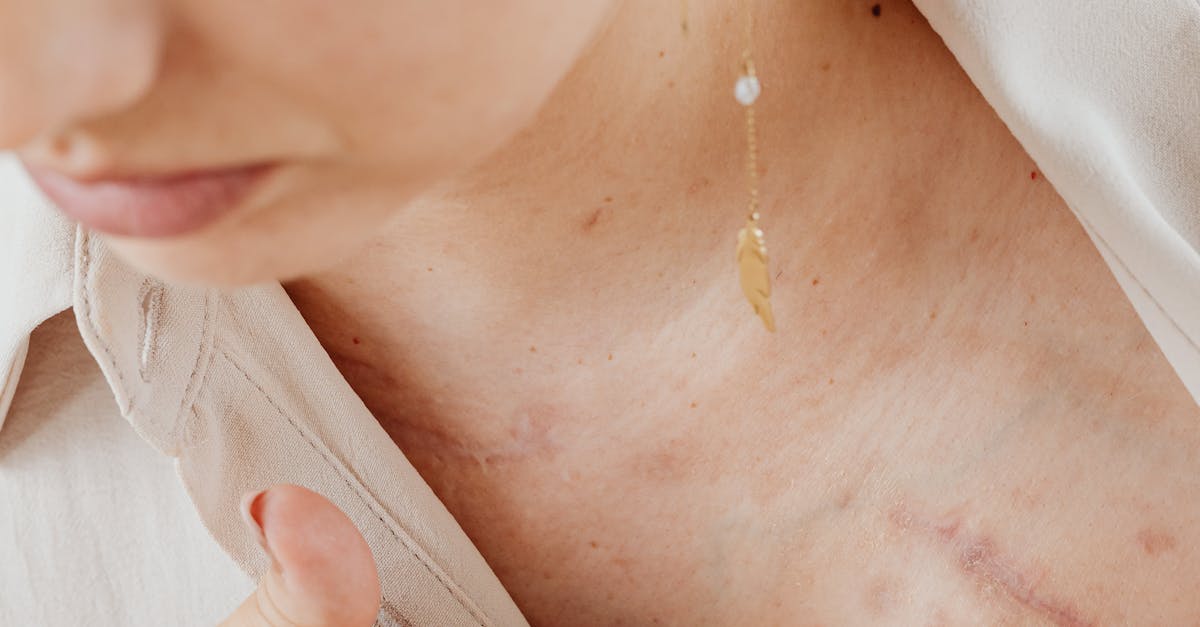 Haavoittuvuus - Arvet kertovat tarinaa: Löydä voimasi ja kauneutesi särkyneisyydestä